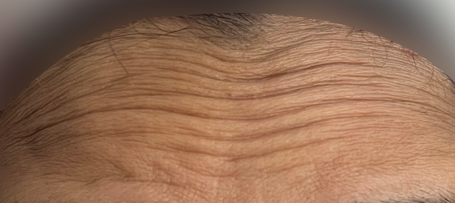 After dermatology result