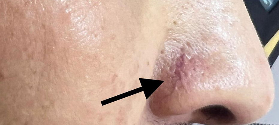 Before dermatology result