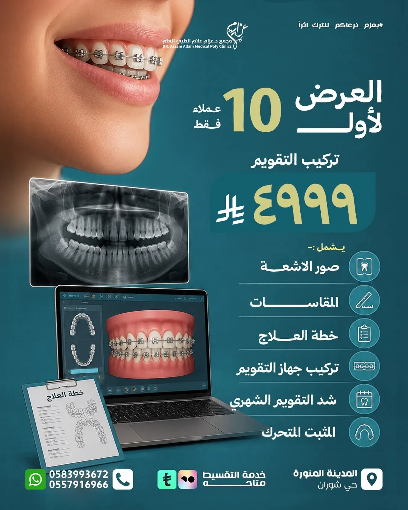 عرض تركيب التقويم